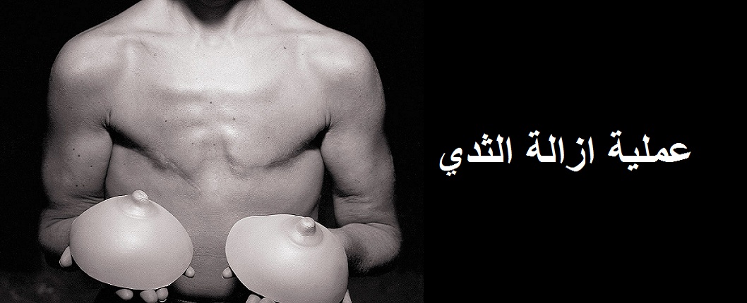 عملية تحويل الجنس من الانثى الى ذكر في الهند مع افضل طب