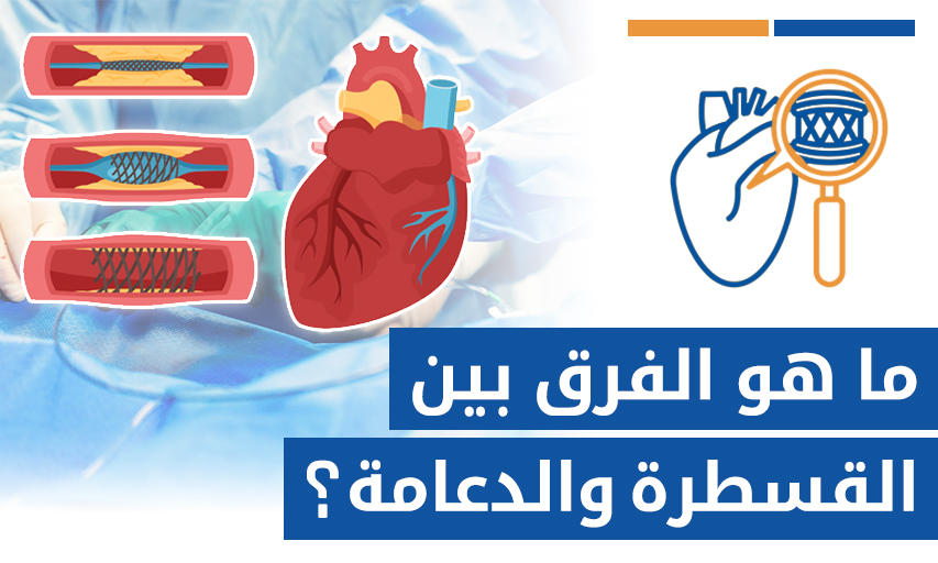 ما هو الفرق بين القسطرة والدعامة؟