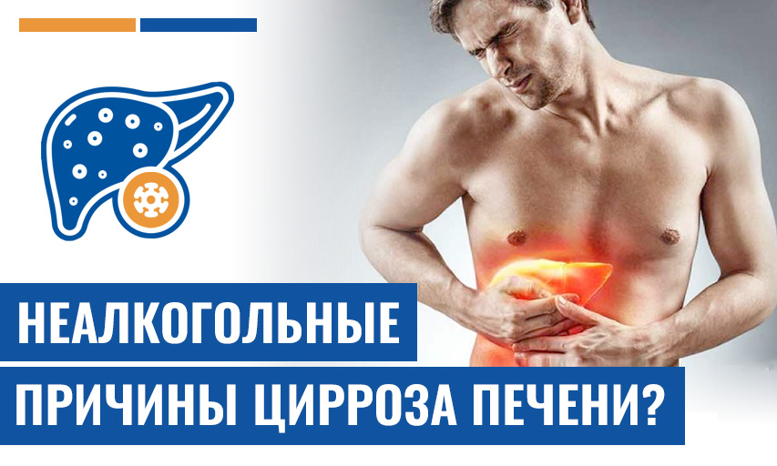 Можно Ли Циррозе Печени У Пациентов, Не Страдающих Алкоголизмом?