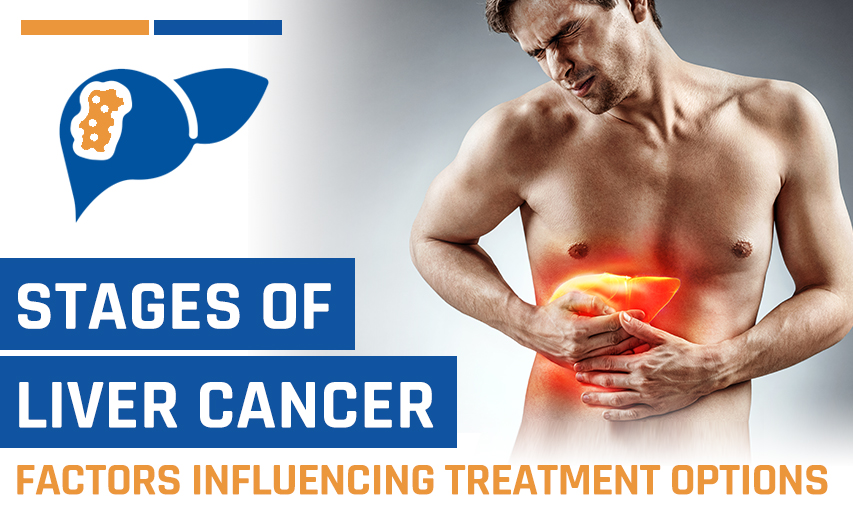 Stages of Liver Cancer and How the Treatment Options Vary