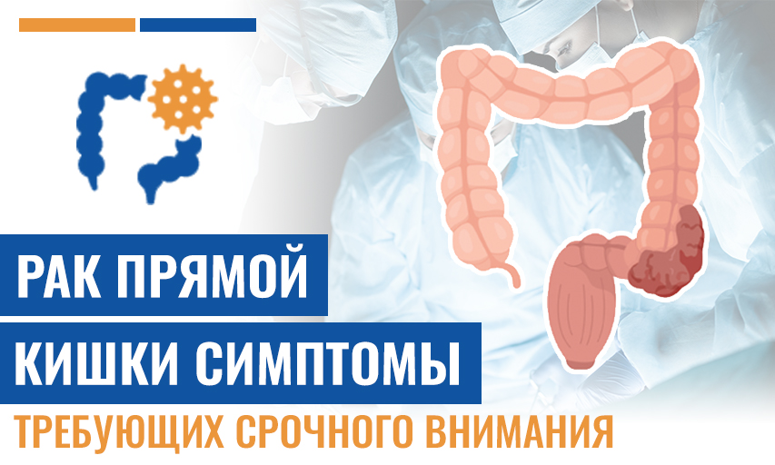 7 Рак Прямой Кишки Симптомы, Требующих Срочного Внимания