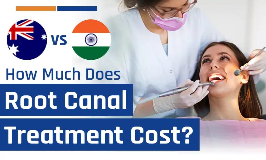 how-much-does-root-canal-treatment-cost-australia-vs-india