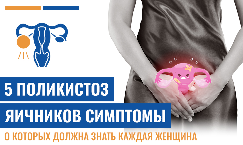 5 Поликистоз Яичников Симптомы, О Которых Должна Знать Каждая Женщина