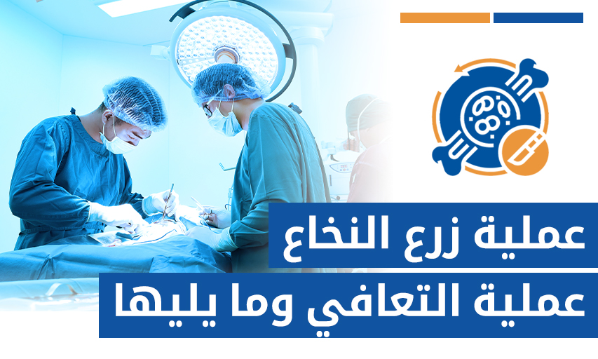 ما بعد عملية زرع النخاع: عملية التعافي وما يليها