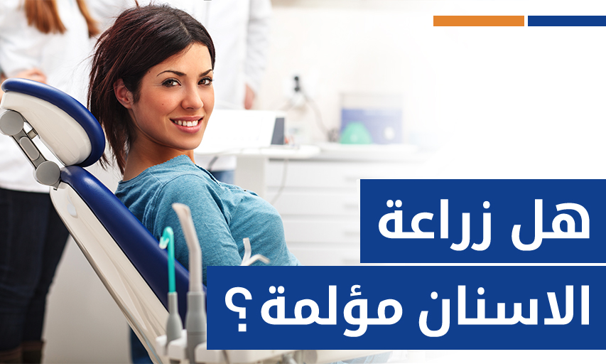 هل زراعة الاسنان مؤلمة؟