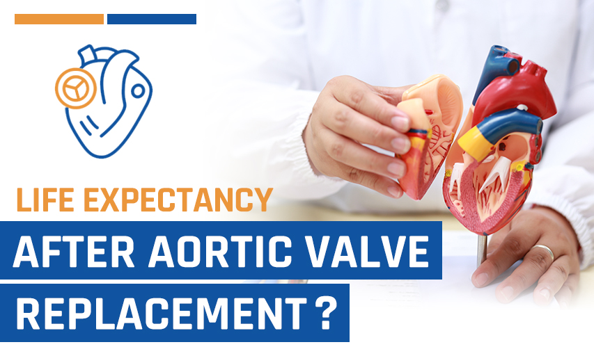 What is Life Expectancy After Aortic Valve Replacement?
