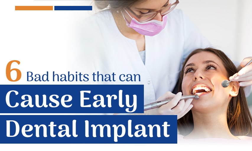 6 Bad Habits That Can Cause Early Dental Implant Failure