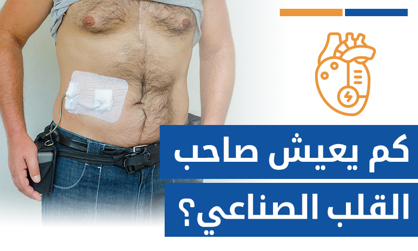 كم يعيش صاحب القلب الصناعي أو جهاز LVAD