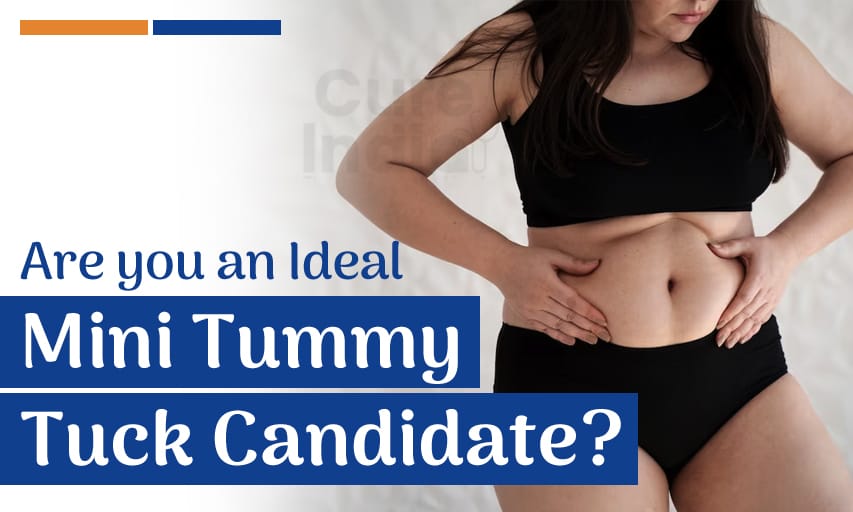 https://www.cureindia.com/images/uploads/blogimage/536782824Who%20is%20an%20Ideal%20mini%20tummy%20tuck%20candidate.jpg