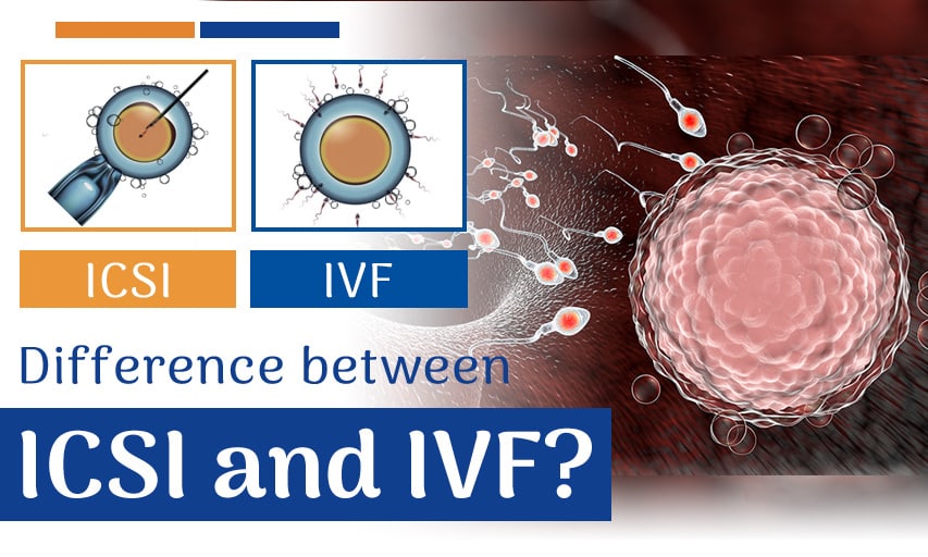 What is the difference between ICSI and IVF?