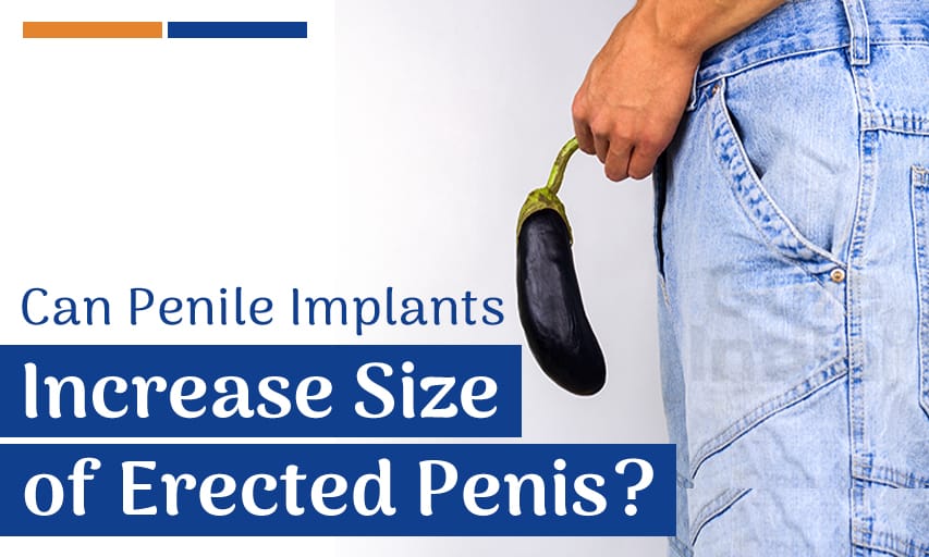 Can Penile Implants Increase the Size of the Erected Penis?