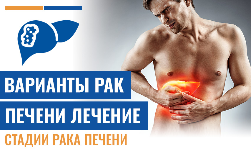 Стадии Рака Печени И Как Различаются Варианты Рак Печени Лечение