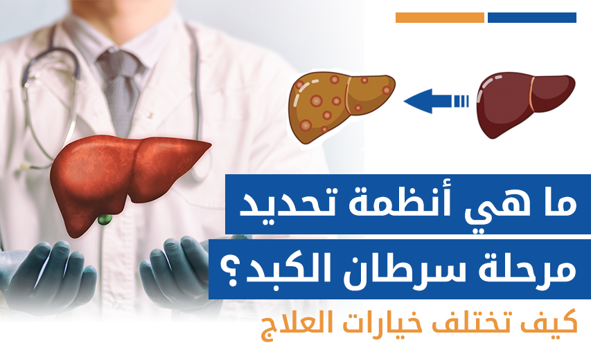 مراحل تطور سرطان الكبد وكيف تختلف خيارات العلاج