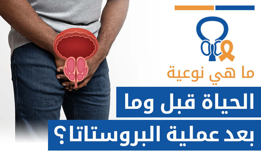 ما هي نوعية الحياة قبل وما بعد عملية البروستاتا؟