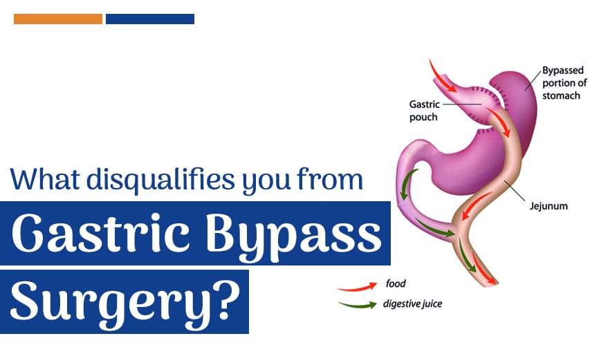 What can Disqualify you from Bariatric Surgery?