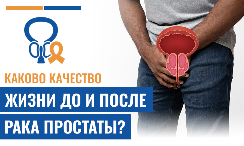 Каково Качество Жизни До И После Рака Простаты?