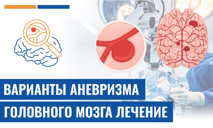 Какие Размер Аневризмы Головного Мозга Требуют Хирургического Вмешательства?
