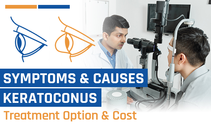 5 Keratoconus Symptoms to Watch For & How Surgery Can Help Fix 'Em