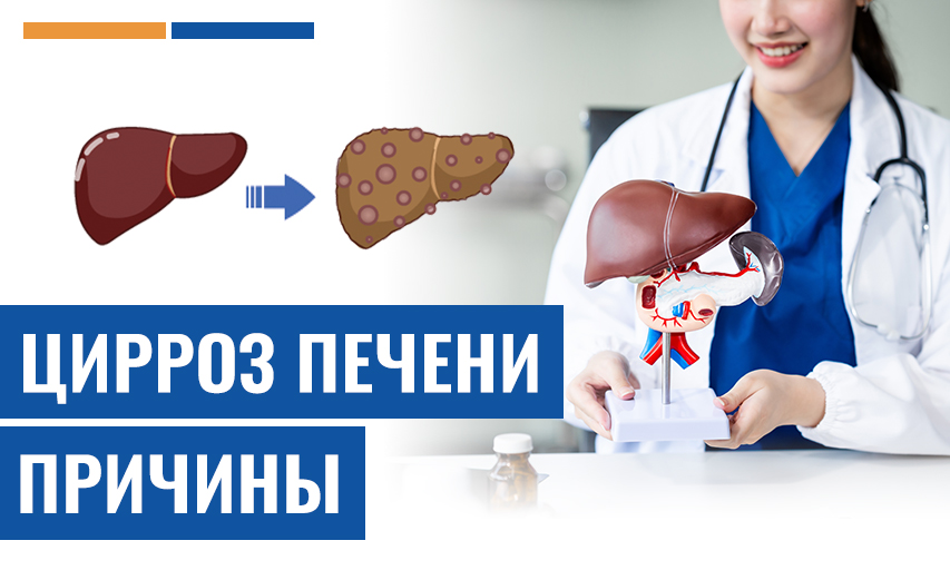 5 Цирроз Печени Причины - Которые Могут Привести К Трансплантации Печени