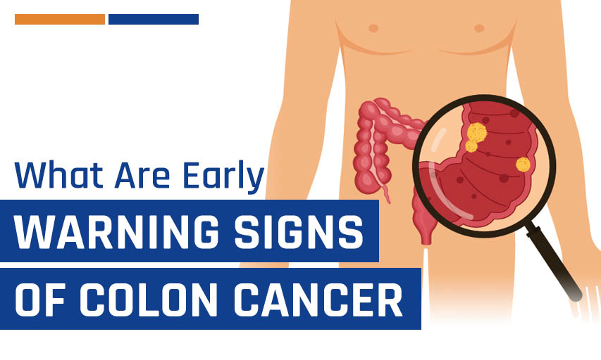 What are the 7 Early Warning Signs of Colon Cancer?