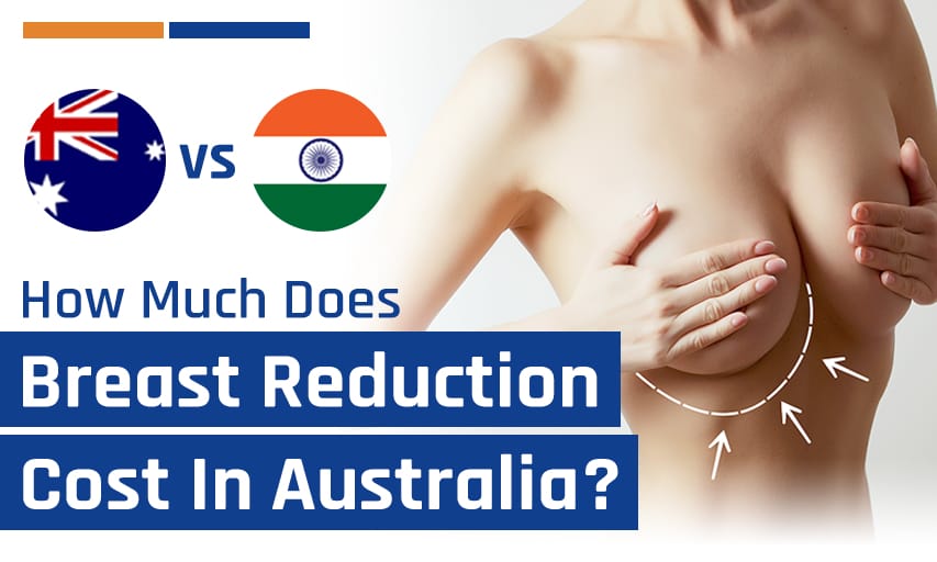How Much Does Breast Reduction Cost in Australia vs India?