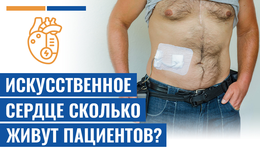 Люди Искусственное Сердце Сколько Живут?