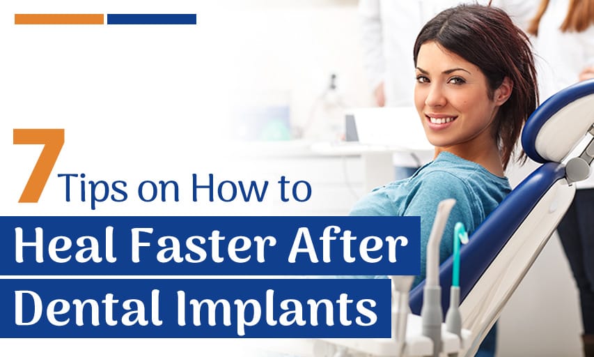 7 Tips on How to Heal Faster After Dental Implants