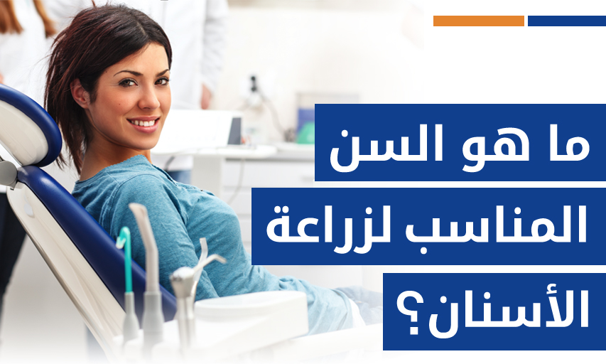 ما هو السن المناسب لزراعة الأسنان؟