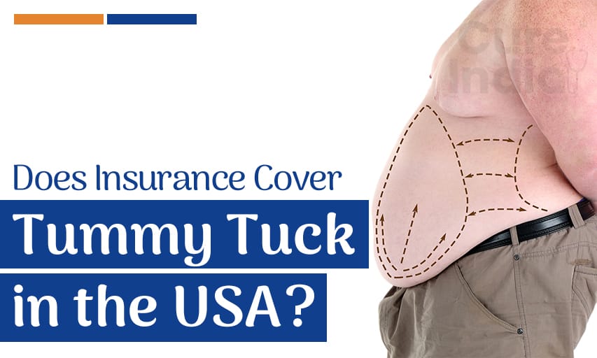 Does Insurance Cover Tummy Tuck in the USA?