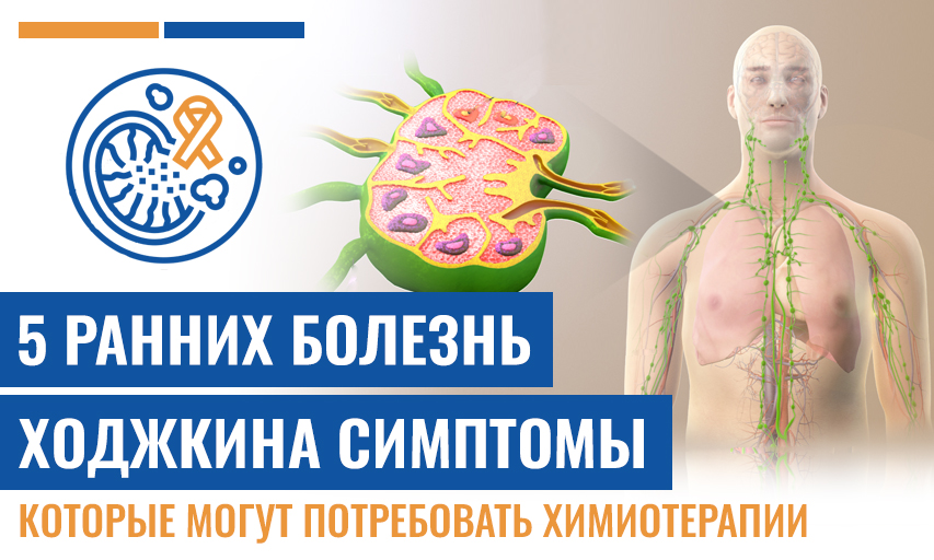 5 Ранних Болезнь Ходжкина Симптомы, Которые Могут Потребовать Химиотерапии В Дальнейшем
