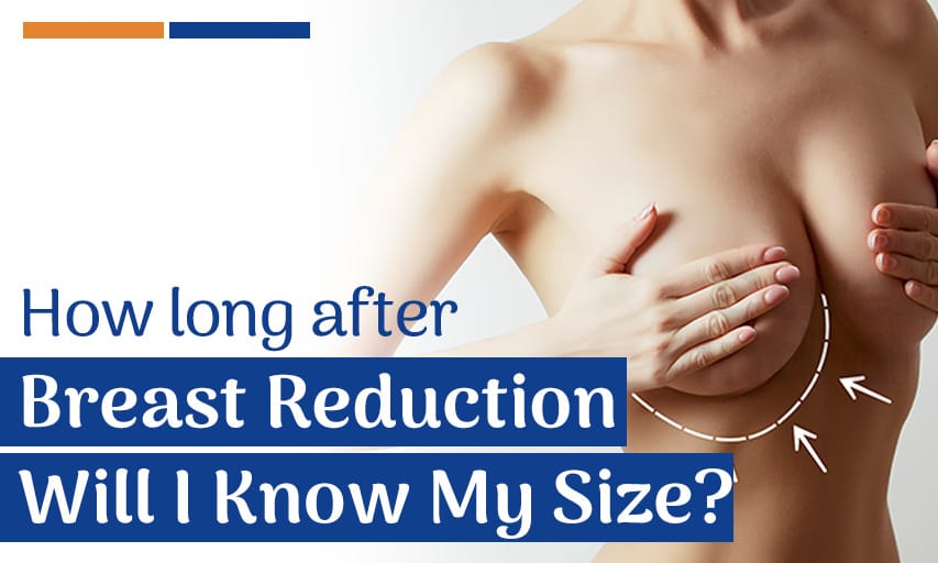 How Long After Breast Reduction Will I Know My Size?