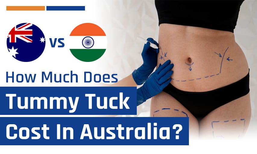 How Much Does a Tummy Tuck Cost Australia Vs India?