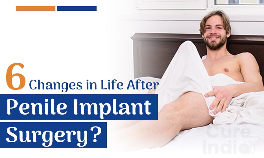 6 Changes in Life After Penile Implant Surgery?