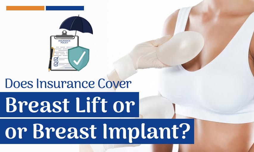 Does Insurance Cover Breast Lift or Breast Implant?