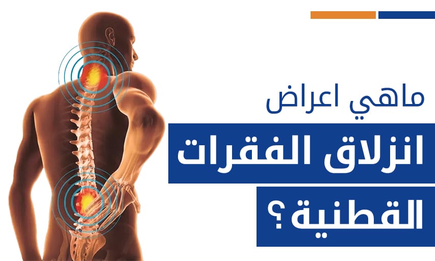 ماهي اعراض انزلاق الفقرات القطنية ؟