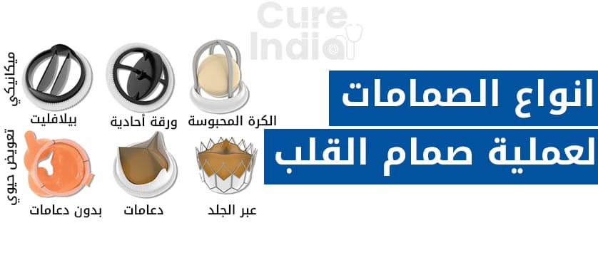 عملية-صمام-القلب-أنواع-الصمامات