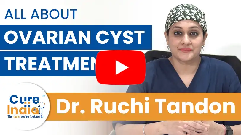 dr-ruchi-tandon-ovarian-cyst-treatment-in-india