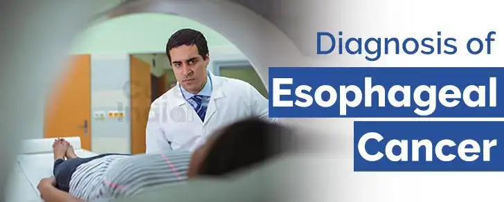 diagnosis-of-esophageal-cancer