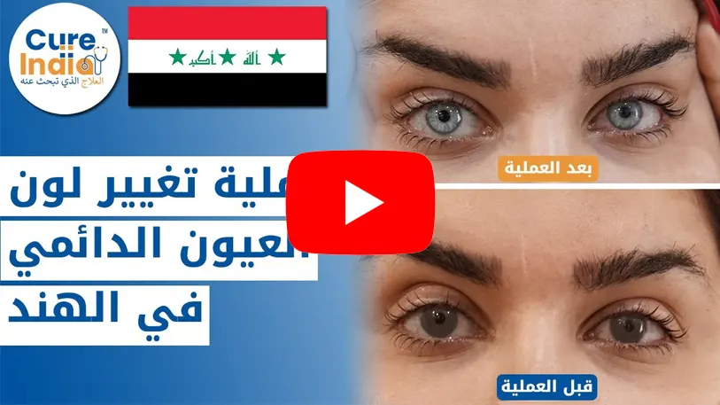 المريضة من العراق في الهند لعملية تغير لون العين