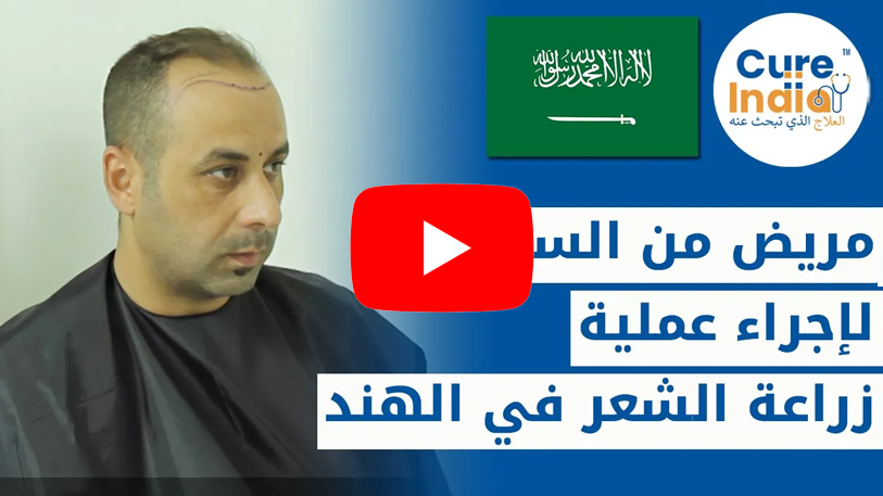 تجربة مريض سعودي كيف تتم عملية زراعة الشعر بالاقتطاف في الهند