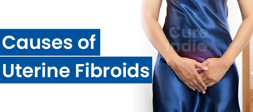 Causes of Uterine Fibroids