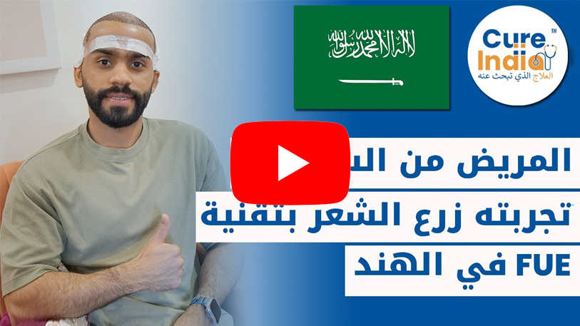تجربة مريض سعودي في زراعة الشعر قبل وبعد بتقنية FUE في الهند