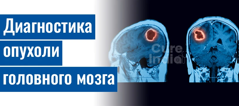 Диагностика Опухоли Головного Мозга