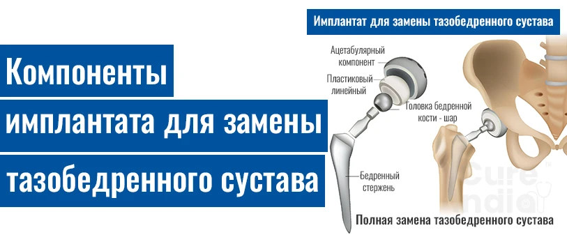 Методы По Замене Тазобедренного Сустава