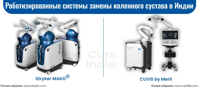 Роботизированная Операция По Замене Коленного Сустава