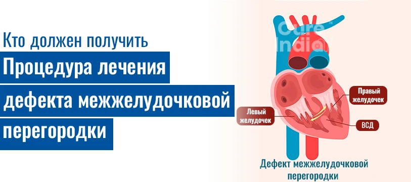 Кому Следует Пройти Процедуру Дефект Межжелудочковой Перегородки Лечение