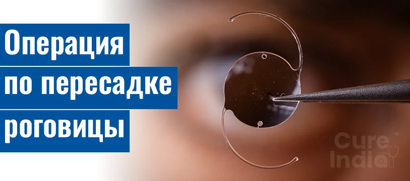 Пересадка Роговицы Хирургия В Индии