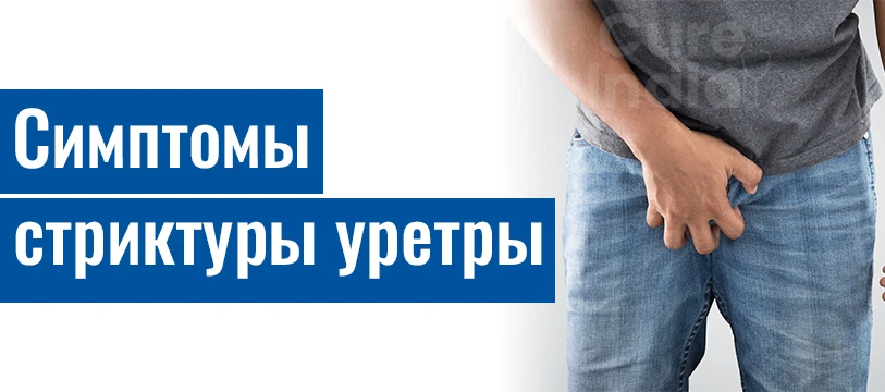 Признаки И Симптомы Стриктуры Уретры