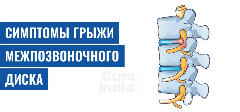 Симптомы Грыжи Межпозвоночного Диска