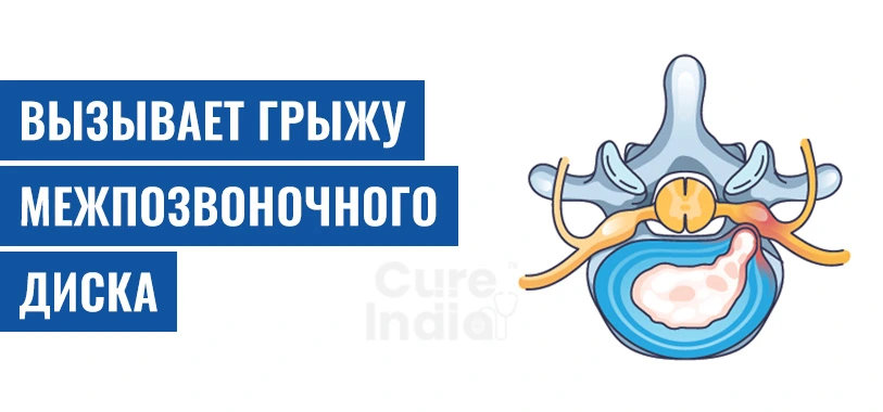 Вызывает Грыжу Межпозвоночного Диска